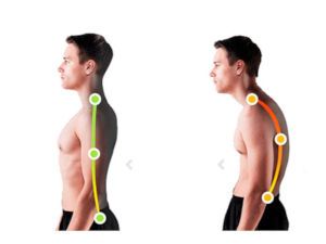 Исправление осанки фото