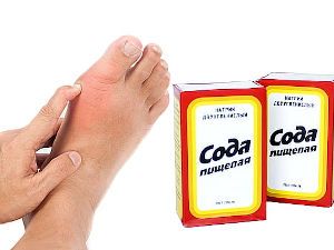 Нога и пищевая сода