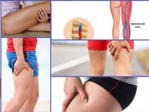 Немеет нога выше колена причины. Онемение бедра с наружной стороны. Онемение ноги от бедра до колена. Онемение наружной стороны бедра выше колена. Болит нога от бедра до колена.